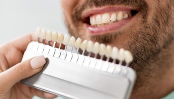 Choosing Dental Veneers