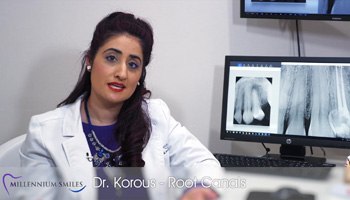 ROOT CANAL TREATMENT IN FRISCO, TX