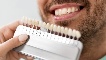 Information You Must Have Before Getting Dental Veneers