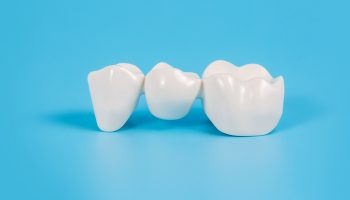 What Is the Purpose of Using Crowns on Teeth?