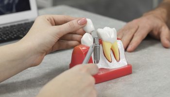 The Lifelong Benefits of Dental Implants: Improving Oral Health and Function for the Long Term