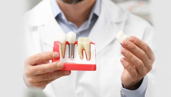 What Makes Dental Implants the Most Ideal Solution for a Missing Tooth?
