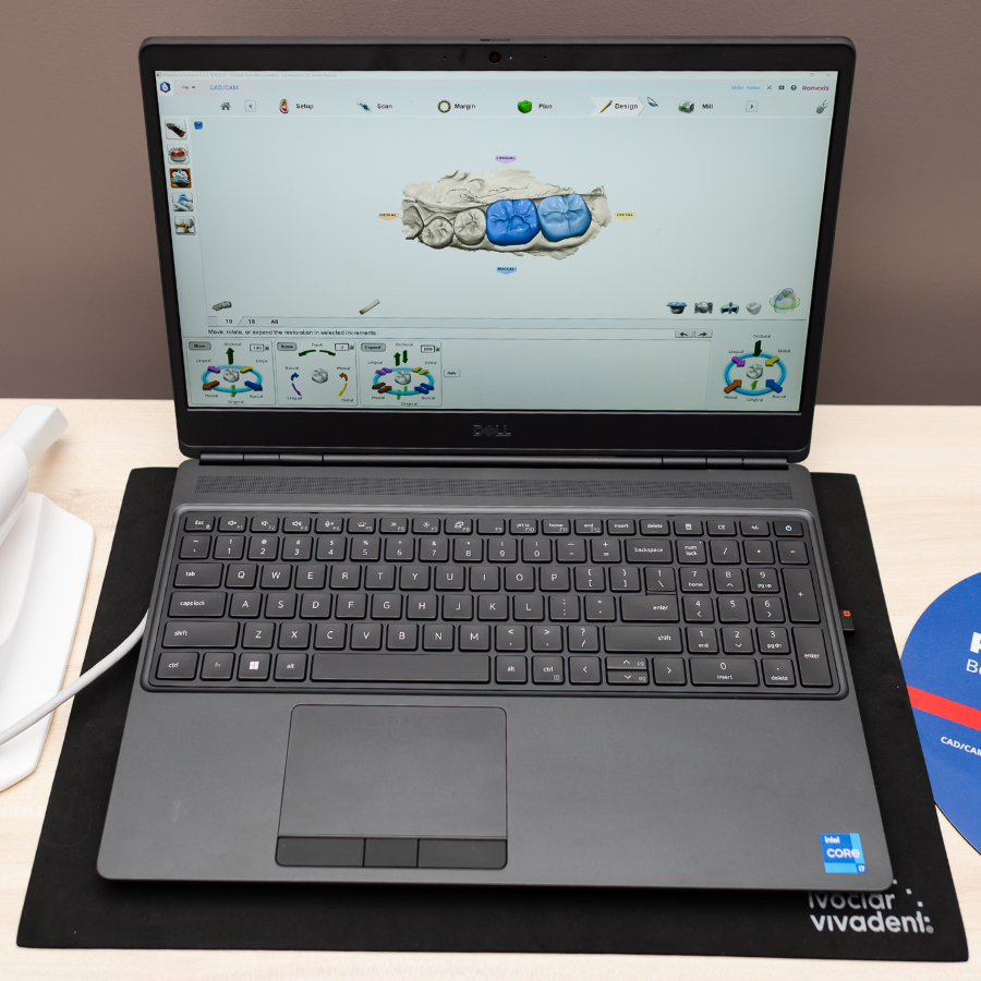 Laptop displaying 3D dental design software with a tooth model