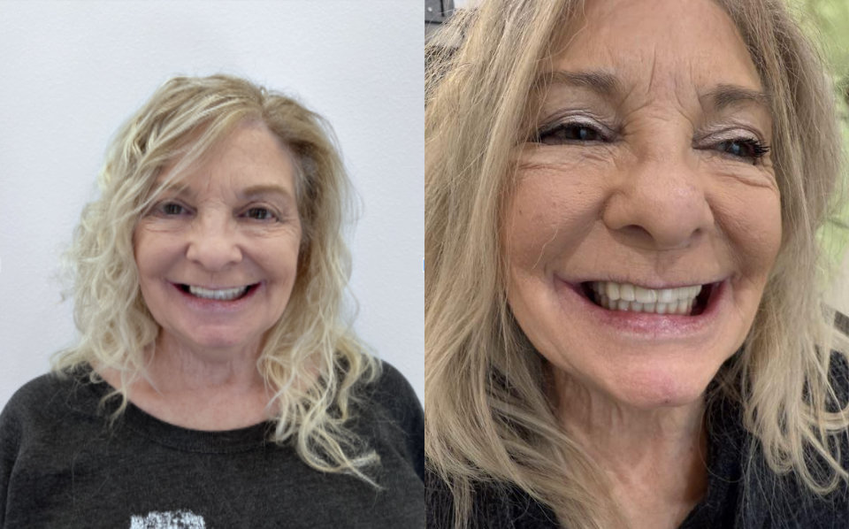 A woman with blonde hair is smiling in both photos. The left image is a portrait with a white background, while the right image is a close-up with a blurred outdoor background.