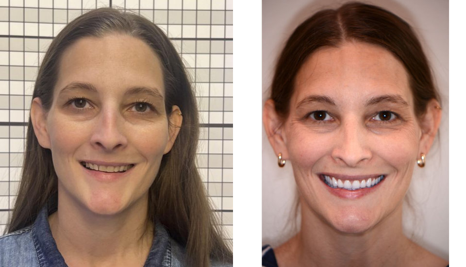 Two side-by-side portraits of the same woman with long brown hair, smiling. The left image has a grid background; the right has a plain background. There are visible changes in her teeth and smile between the photos.